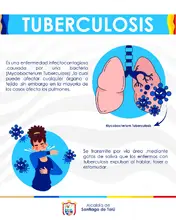 tubercolosis